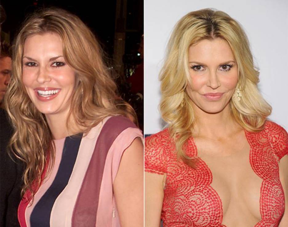 Take a Look at Brandi Glanville Before and after Plastic Surgery and See th...